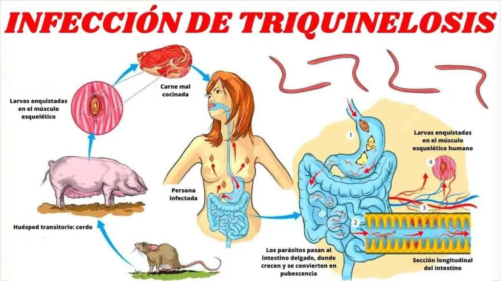 Infografía sobre cómo actúa la triquinelosis transmitida por los jabalíes
